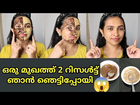 😱ഏതാ നല്ലത് നിങ്ങൾ തന്നെ കണ്ടു പിടിച്ചോളൂ ✅|Multtanimitti v/s Coffe powder | skin brightening tips