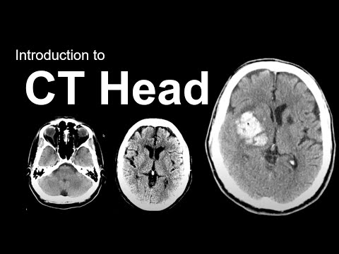 Introduction to CT Head: Approach and Principles