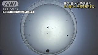 「線虫」使った尿検査で、すい臓がんを早期診断(2021年11月16日)