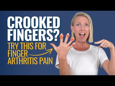 Can I Fix my Crooked Fingers? Try this 1 Tip to Help Your Finger Arthritis Pain and Stop Deformities