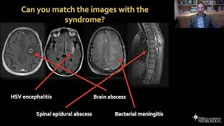 Virtual Resident Education Lecture Series: Neuroinfectious Diseases - American Academy of Neurology