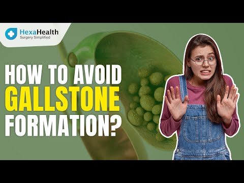 Know all about gallstones & their treatment || HexaHealth Expert Dr. Paras Gupta