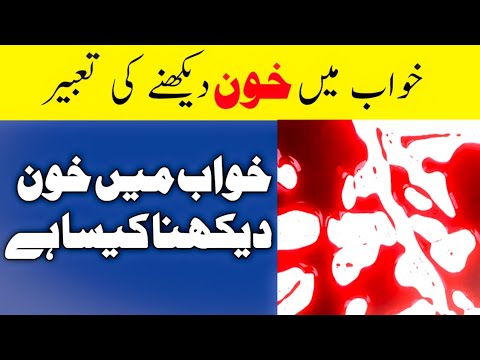 Khwab mein khoon dekhna | khwab mein zakham dekhna | dream meaning in urdu/hindi