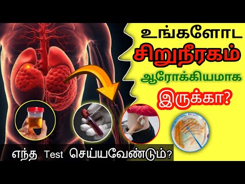 உங்களோட சிறுநீரகம் ஆரோக்கியமாக இருக்கா? | எந்த Test செய்யவேண்டும்? | STAR LABORATORY