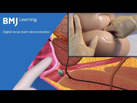 Digital rectal exam demonstration from BMJ Learning