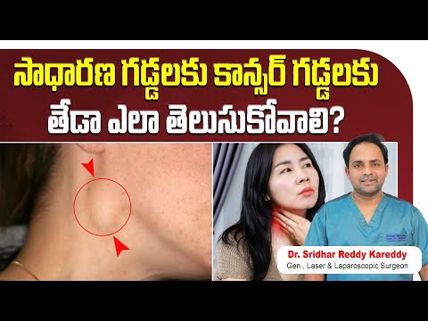 Difference Between Cancer Tumor and Normal Tumor || What Causes Swollen Lymph Nodes in Neck