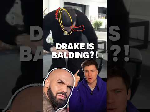 DRAKE IS BALDING?! 😮