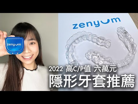 Zenyum 隱形牙套矯正過程｜台灣評價｜附 1 萬 3 千元折扣碼 🦷 😁