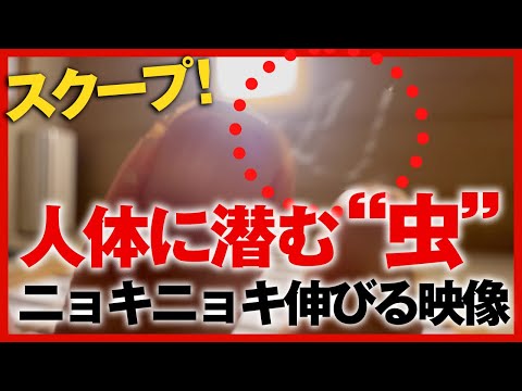 【スクープ！】指からニョキニョキ伸びる「虫」の映像をお届け！｜網戸理九