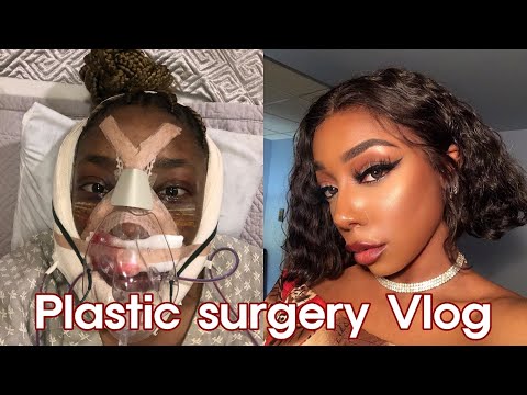 Plastic Surgery In Korea Vlog Part 1 | Zarabeaute