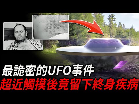 人类历史上最诡秘的UFO事件！目击者伸手触碰后竟留下终身疾病，臨終前終於說出驚天真相，NASA全體震動！他究竟說了什麼？