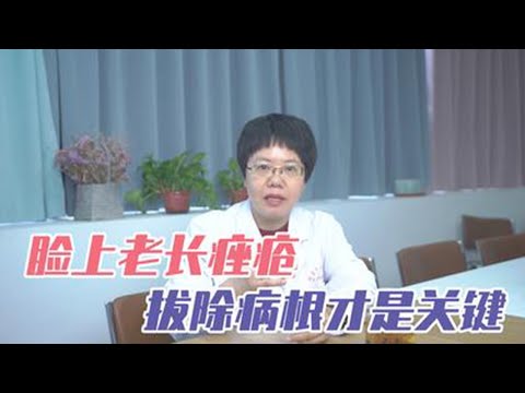 健康|生活|脸上长痤疮，反复发作怎么办？医生：最好的治疗方法其实不是用药，臉上長痤瘡，反復發作怎麼辦？醫生：最好的治療方法其實不是用藥