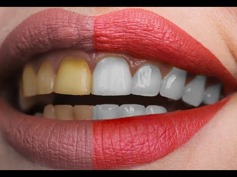 How to Whiten Teeth in Photoshop