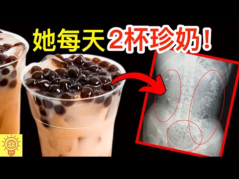 她每天喝兩杯珍珠奶茶, 結果身體發生驚人變化, 連醫生都看傻眼....