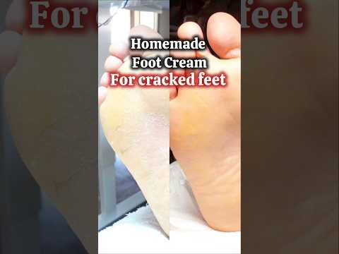 Homemade remedy for Healing Cracked Feet/ फटी एड़ियों के लिए घरेलु उपाय/Natural healing #shorts