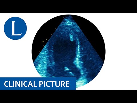 Takotsubo cardiomyopathy in a patient with Lynch syndrome