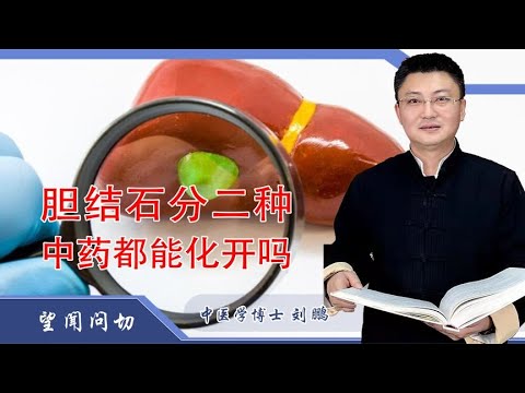 二种胆结石都能化开吗？治疗上有什么区别吗？