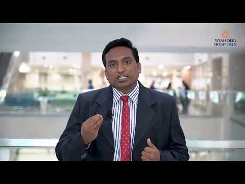 Varicose Veins | Causes |  Prevention | Yashoda Hospitals | Dr.Srikanth Raju |Vascular Surgeon