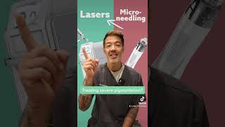 Micro-needling vs Lasers