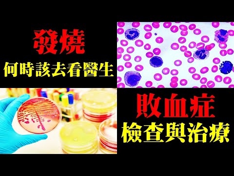 發燒何時該去看醫生？敗血症的檢查及治療｜許原彰醫師：高雄宇成診所