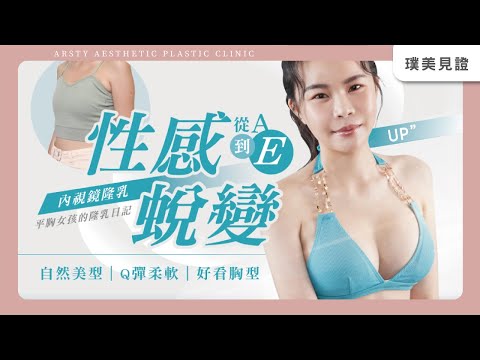 隆乳見證｜擺脫胸部小沒自信的陰影！平胸女孩隆乳性感蛻變，從Ａ到Ｅ魅力大增！#台北隆乳 #璞美隆乳