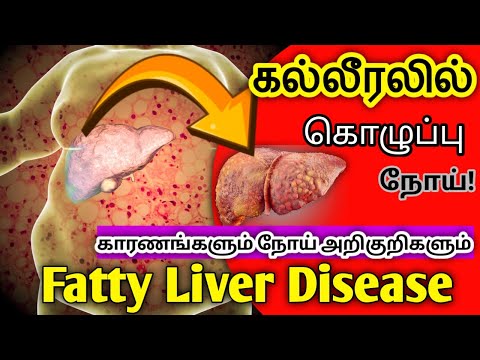 இந்த நோய் அறிகுறிகள் இருந்தால் அவதானம் | Beware of these symptoms | Liver problem symptoms in tamil