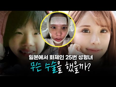 성형수술 25번?! 성형으로 인생을 바꾼 일본인, 하지만 아쉬운 점이 있다?!