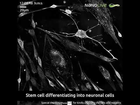 Examining the morphological changes stem cells undergo after exposure to neurogenic differentiation