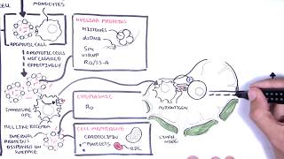 Systemic Lupus Erythematosus (SLE) - signs and symptoms, pathophysiology, investigations, treatment