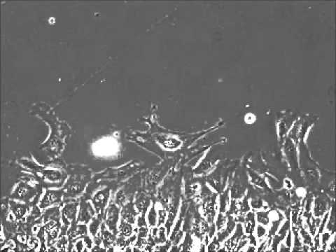 How the p53 gene controls cells movement