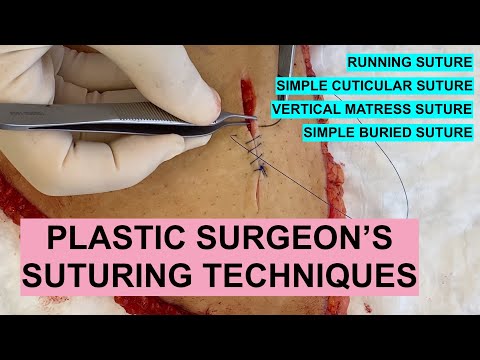 Plastic Surgeon's SUTURE TECHNIQUES (Running, Simple Cuticular, Vertical Mattress and Simple Buried)