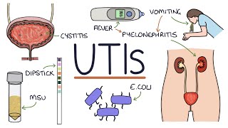 Understanding Urinary Tract Infections