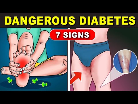 7 Dangerous Morning Diabetes Signs You Should Know - Healthy lifestyle