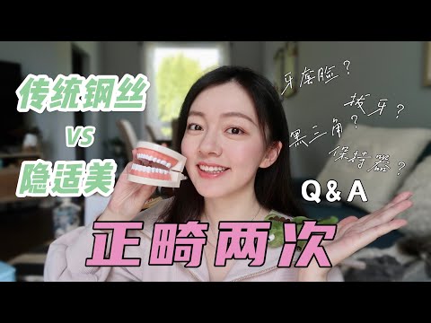 两次正畸超干货经验分享 | Invisalign VS 传统钢丝 | 拔牙 | 牙套脸 | 黑三角 | 保持器 | 整牙必备好物 | Q&A