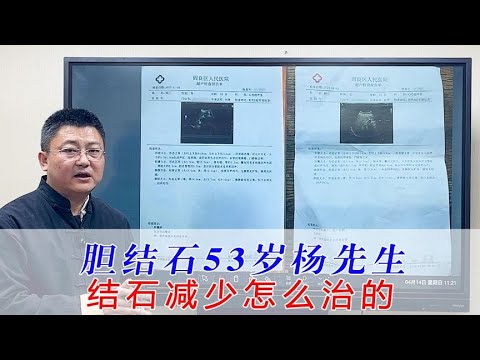 53岁的杨先生结石减少是怎么治疗的