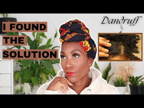 How to stop your SCALP from ITCHING | How to GET RID of DANDRUFF