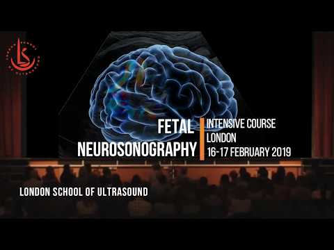 Fetal Neurosonography: Intensive Ultrasound Course - London 16-17 Feb 2019