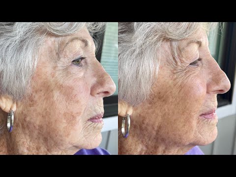 Mature Skin and Demi Method with Self Tanner Pen