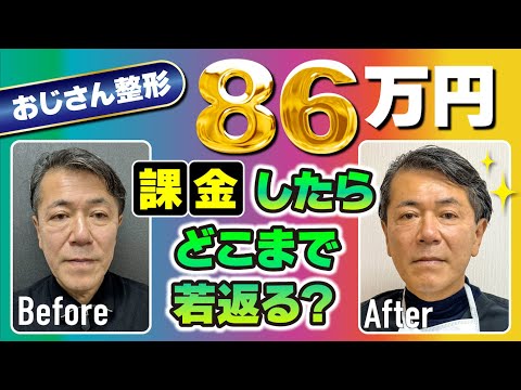 おじさんだって綺麗になりたい！課金86万円で何歳若返る！？ 桑満医師が体を張りました！ #整形 #おじさん整形