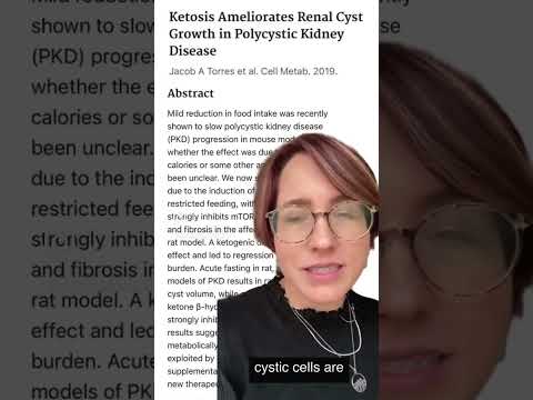 Exciting breakthrough in PKD research!  - Ketosis Ameliorates Renal Cyst Growth in PKD