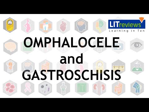 Omphalocele and Gastroschisis