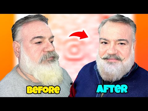 How To Curly Beard Without Cutting | Beard Ko Curly Kese Kare | Beard Curly hair Treatment At Home