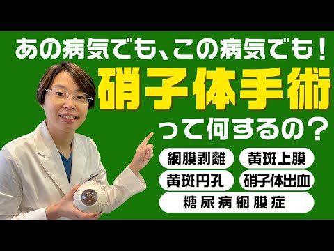 アレもコレも!? 【網膜硝子体手術】　糖尿病網膜症・網膜剥離・硝子体出血