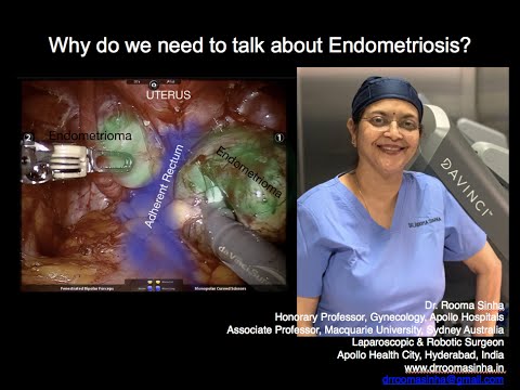 Why do we need to talk about endometriosis? Dr Rooma Sinha Apollo Hospitals, Hyderabad