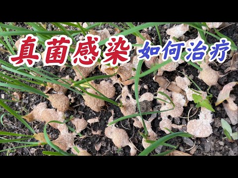 真菌感染如何治疗？