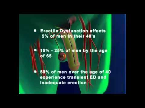 What is Erectile Dysfunction and the Cause of this Dysfunction?