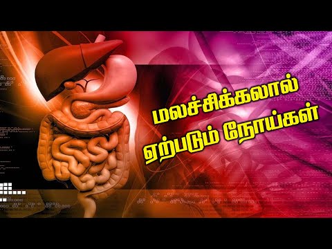 மலச்சிக்கலால் ஏற்படும் நோய்கள்  | Dr Sivaraman | Kavi Online