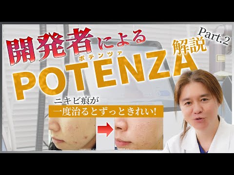 【ニキビ痕】開発者がPOTENZA(ポテンツァ)のすごさを徹底解説 Part2！！学会を沸かせた改善結果の症例を大量公開！！