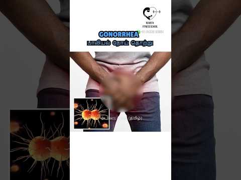 Gonorrhoeae பாலியல் நோய் தொற்று- Dr. Isacc Abbas