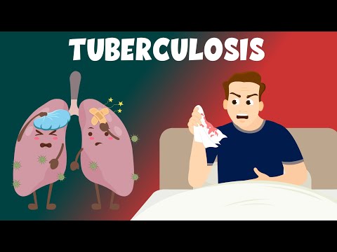 Tuberculosis: Causes, Symptoms, Diagnosis & Treatment - Learning Junction